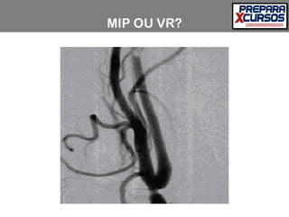 MIP OU VR?
 