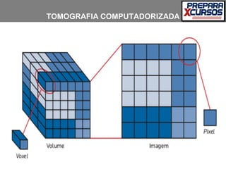 TOMOGRAFIA COMPUTADORIZADA
 