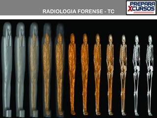 RADIOLOGIA FORENSE - TC
 