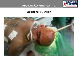 ACIDENTE - 2012
APLICAÇÃO PRÁTICA - TC
 