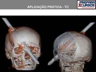 APLICAÇÃO PRÁTICA - TC
 