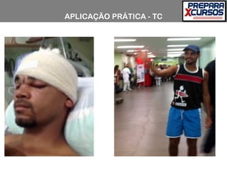 APLICAÇÃO PRÁTICA - TC
 