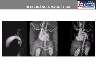 RESSONÂNCIA MAGNÉTICA
 