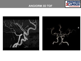 ANGIORM 3D TOF
 