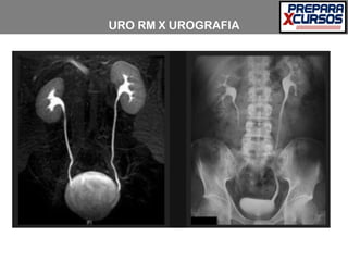 URO RM X UROGRAFIA
 