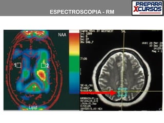 ESPECTROSCOPIA - RM
 