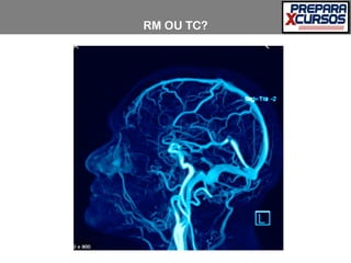 RM OU TC?
 
