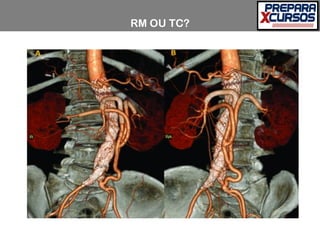 RM OU TC?
 