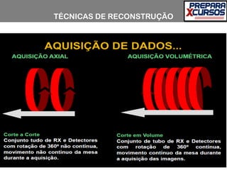 TÉCNICAS DE RECONSTRUÇÃO
 
