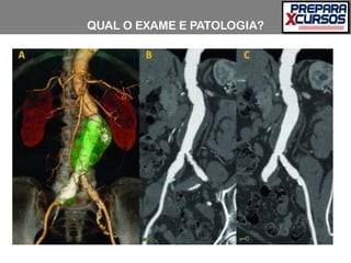 QUAL O EXAME E PATOLOGIA?
 