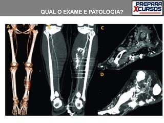 QUAL O EXAME E PATOLOGIA?
 