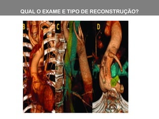 QUAL O EXAME E TIPO DE RECONSTRUÇÃO?
 