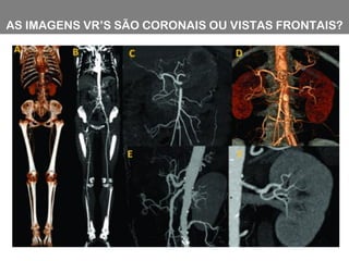 AS IMAGENS VR’S SÃO CORONAIS OU VISTAS FRONTAIS?
 