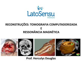 RECONSTRUÇÕES: TOMOGRAFIA COMPUTADORIZADA
E
RESSONÂNCIA MAGNÉTICA
Prof. Herculys Douglas
 