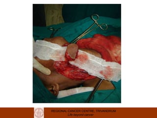 REGIONAL CANCER CENTRE, TRIVANDRUM
Life beyond cancer
 