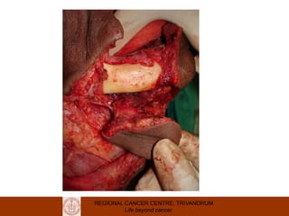 REGIONAL CANCER CENTRE, TRIVANDRUM
Life beyond cancer
 