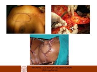 REGIONAL CANCER CENTRE, TRIVANDRUM
Life beyond cancer
 