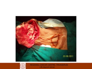 REGIONAL CANCER CENTRE, TRIVANDRUM
Life beyond cancer
 