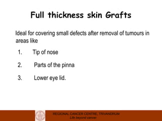REGIONAL CANCER CENTRE, TRIVANDRUM
Life beyond cancer
Full thickness skin Grafts
Ideal for covering small defects after removal of tumours in
areas like
1. Tip of nose
2. Parts of the pinna
3. Lower eye lid.
 