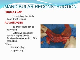 MANDIBULAR RECONSTRUCTION
FIBULA FLAP
It consists of the fibula
bone & soft tissues
ADVANTAGES
25 cm of fibula can be
harvested
Extensive periosteal
vascular supply allows
functional reconstruction of the
mandibule
Others
Iliac crest flap
scapular flap
 
