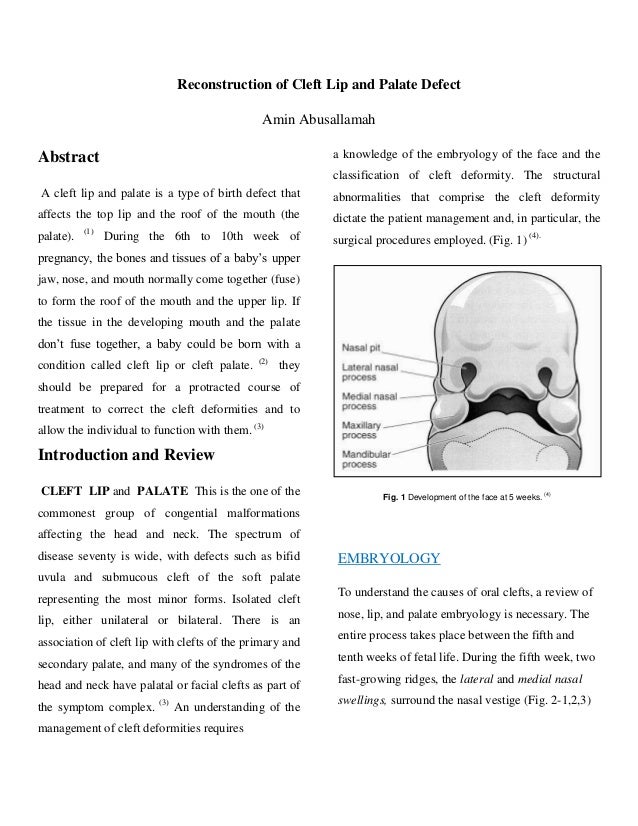 Article of Reconstruction of cleft lip and palate defect