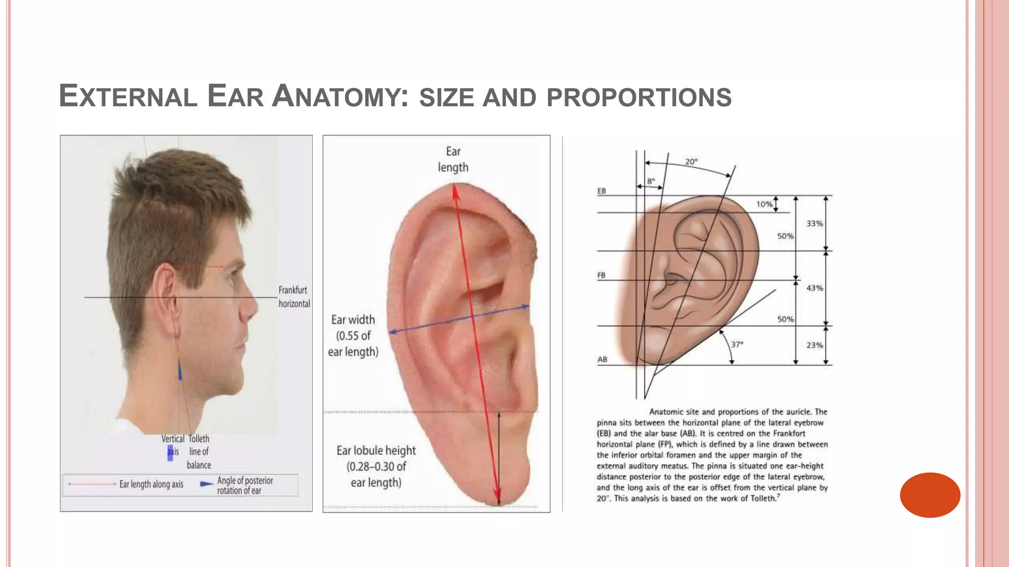 Reconstruction of ear | PPTX