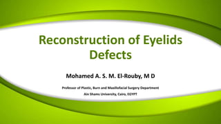 Reconstruction of Eyelids
Defects
Mohamed A. S. M. El-Rouby, M D
Professor of Plastic, Burn and Maxillofacial Surgery Department
Ain Shams University, Cairo, EGYPT
 