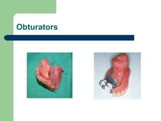 Obturators
 
