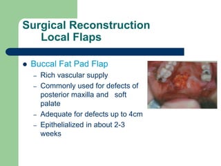 Surgical Reconstruction
Local Flaps
 Buccal Fat Pad Flap
– Rich vascular supply
– Commonly used for defects of
posterior maxilla and soft
palate
– Adequate for defects up to 4cm
– Epithelialized in about 2-3
weeks
 