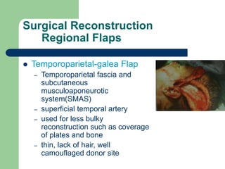 Surgical Reconstruction
Regional Flaps
 Temporoparietal-galea Flap
– Temporoparietal fascia and
subcutaneous
musculoaponeurotic
system(SMAS)
– superficial temporal artery
– used for less bulky
reconstruction such as coverage
of plates and bone
– thin, lack of hair, well
camouflaged donor site
 