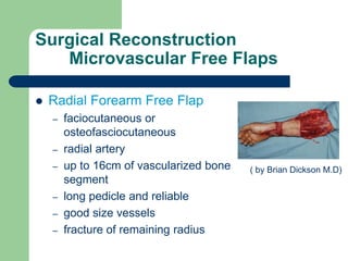 Surgical Reconstruction
Microvascular Free Flaps
 Radial Forearm Free Flap
– faciocutaneous or
osteofasciocutaneous
– radial artery
– up to 16cm of vascularized bone
segment
– long pedicle and reliable
– good size vessels
– fracture of remaining radius
( by Brian Dickson M.D)
 