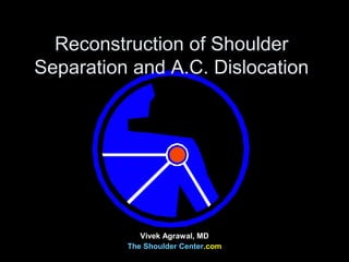 Reconstruction of Shoulder
Separation and A.C. Dislocation
Vivek Agrawal, MD
The Shoulder Center.com
 