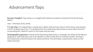 Advancement flaps
Burrows Triangle’s: Flap moves in a straight path without any lateral movement into the primary
defect.
sites – forehead, brow, cheek.
V-Y adv. Flap: A V shaped flap is moved into a defect with primary closure of the donor area leaving
a final Y shaped suture line. It is pedicled from the underlying subcutaneous tissue rather than the
surrounding skin. Ideal for Lesion in the cheek and alar base.
Panthographic expansion: instead of the flap being advanced as a rectangle, the limbs of the flap are
designed at 120º with back cuts at the bottom so that it looks like an inverted tumbler. The flap is
then advanced so that the donor site closes primarily. This technique is particularly useful on the
cheek and neck.
 
