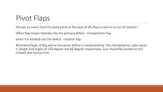 Pivot Flaps
Derives its name from the pivot point at the base of the flap as well as its arc of rotation .
When flap moves laterally into the primary defect - transposition flap
when it is rotated into the defect - rotation flap
Rhomboid flaps: A flap where the donor defect is closed directly. The rhomboid has sides equal
in length and angles of 120 degree and 60 degree respectively. Scar should be parallel to the
relaxed skin tension line.
 