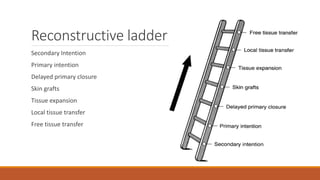 Reconstructive ladder
Secondary Intention
Primary intention
Delayed primary closure
Skin grafts
Tissue expansion
Local tissue transfer
Free tissue transfer
 