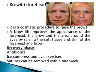  Browlift/foreheadlift
 It is a cosmetic procedure to raise the brows.
 A brow lift improves the appearance of the
forehead, the brow and the area around the
eyes by raising the soft tissue and skin of the
forehead and brow.
Recovery phase:
Antibiotics
Ice compress and eye exercises
Sutures can be removed within one week
 