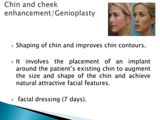  Shaping of chin and improves chin contours.
 It involves the placement of an implant
around the patient’s existing chin to augment
the size and shape of the chin and achieve
natural attractive facial features.
 facial dressing (7 days).
 
