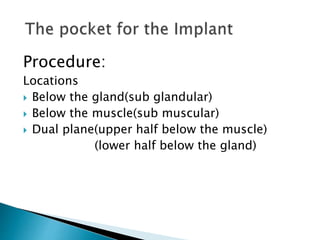 Procedure:
Locations
 Below the gland(sub glandular)
 Below the muscle(sub muscular)
 Dual plane(upper half below the muscle)
(lower half below the gland)
 