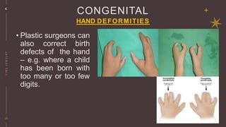 Hand Defect Reconstructive and cosmetic surgery.pptx