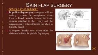 Pedicle Flaps Example Reconstructive and cosmetic surgery.pptx