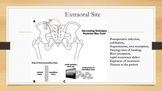 Extraoral Site
Postoperative infection,
exfoliation,
Sequestration, root resorption,
Varying rates of healing,
Root resorption,
rapid recurrence defect
Expences of treatment
Trauma to the patient
 