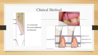 Clinical Method
 