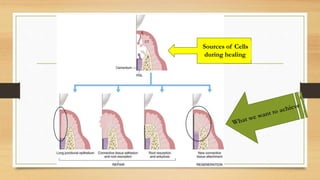 Sources of Cells
during healing
 