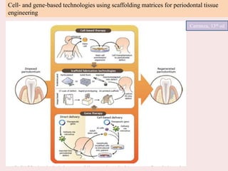 Cell‐ and gene‐based technologies using scaffolding matrices for periodontal tissue
engineering
Carranza, 13th ed
 