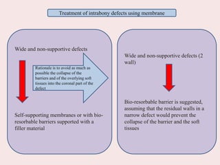 Wide and non-supportive defects
Self-supporting membranes or with bio-
resorbable barriers supported with a
filler material
Wide and non-supportive defects (2
wall)
Bio-resorbable barrier is suggested,
assuming that the residual walls in a
narrow defect would prevent the
collapse of the barrier and the soft
tissues
Treatment of intrabony defects using membrane
Rationale is to avoid as much as
possible the collapse of the
barriers and of the overlying soft
tissues into the coronal part of the
defect
 