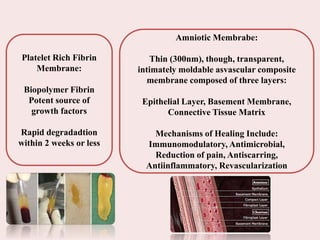 Platelet Rich Fibrin
Membrane:
Biopolymer Fibrin
Potent source of
growth factors
Rapid degradadtion
within 2 weeks or less
Amniotic Membrabe:
Thin (300nm), though, transparent,
intimately moldable asvascular composite
membrane composed of three layers:
Epithelial Layer, Basement Membrane,
Connective Tissue Matrix
Mechanisms of Healing Include:
Immunomodulatory, Antimicrobial,
Reduction of pain, Antiscarring,
Antiinflammatory, Revascularization
 