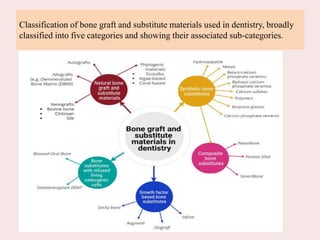 Classification of bone graft and substitute materials used in dentistry, broadly
classified into five categories and showing their associated sub-categories.
 