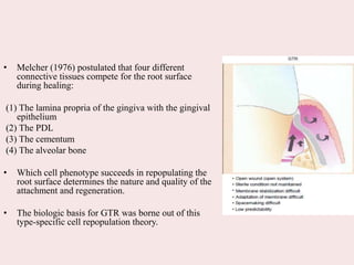 • Melcher (1976) postulated that four different
connective tissues compete for the root surface
during healing:
(1) The lamina propria of the gingiva with the gingival
epithelium
(2) The PDL
(3) The cementum
(4) The alveolar bone
• Which cell phenotype succeeds in repopulating the
root surface determines the nature and quality of the
attachment and regeneration.
• The biologic basis for GTR was borne out of this
type-specific cell repopulation theory.
 