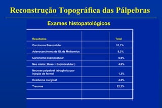 Exames histopatológicos
Resultados Total
Carcinoma Basocelular 51,1%
Adenocarcinoma de Gl. de Meibomius 9,3%
Carcinoma Espinocelular 6,9%
Neo mista ( Baso + Espinocelular ) 4,6%
Necrose palpebral iatrogênica por
injeção de formol 1,3%
Coloboma marginal 4,6%
Traumas 22,2%
Reconstrução Topográfica das Pálpebras
 