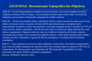 LEGENDAS - Reconstrução Topográfica das Pálpebras
Slide 05 –O autor dessa palestra considera um inconveniente, nos casos de perdas de tecido
marginais extensas (50% ou mais), a necessidade de retirar muito tecido sadio, em forma de
triângulo, para permitir o fechamento adequado do retalho rotatório.
Slide 06 – Assim como também acha a retirada do enxerto condro-mucoso do septo nasal ou do
pálato uma técnica mais avançada e de mais difícil aprendizado para o cirurgião recém
especializado em plástica ocular. Esse paciente, com lesão marginal extensa, operado em 1975 no
nosso serviço, ilustra o problema : não foi possível retirar o enxerto do septo nasal devido a um
intenso sangramento. Optamos então por usar um retalho de conjuntiva do fórnice superior,
tracionado para refazer a face posterior da pálpebra inferior, sendo então recoberto pelo retalho
rotatório de pele e subcutâneo. Apesar da falta da cartilagem, o resultado final foi bastante
satisfatório.
Slide 07 – Essa experiência nos levou então a planejar e desenvolver uma técnica opcional para
esses casos de perdas marginais de espessura total, com extensão igual ou superior a 50% do seu
comprimento. Evoluimos para o que chamamos de "Reconstrução Topográfica” ou seja,
restauração dos quatro folhetos anatômicos palpebrais :
mucosa, cartilagem, músculo e pele.
 